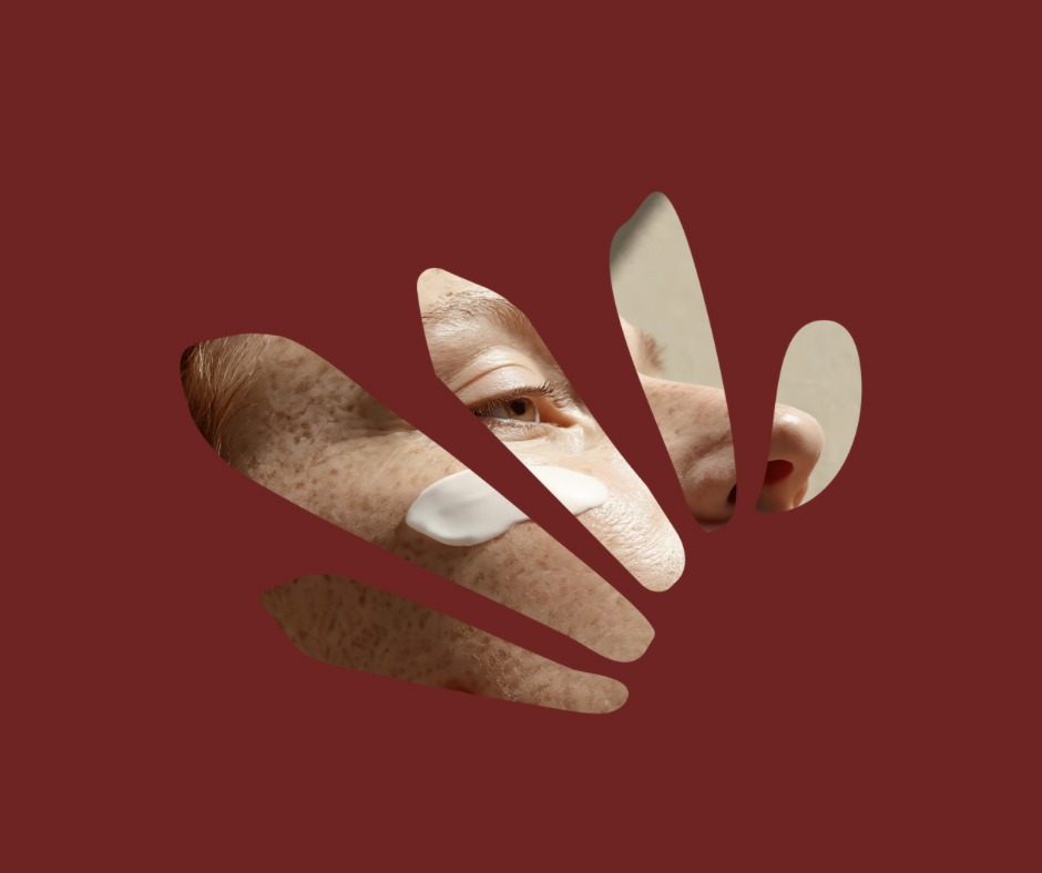 Moisturise