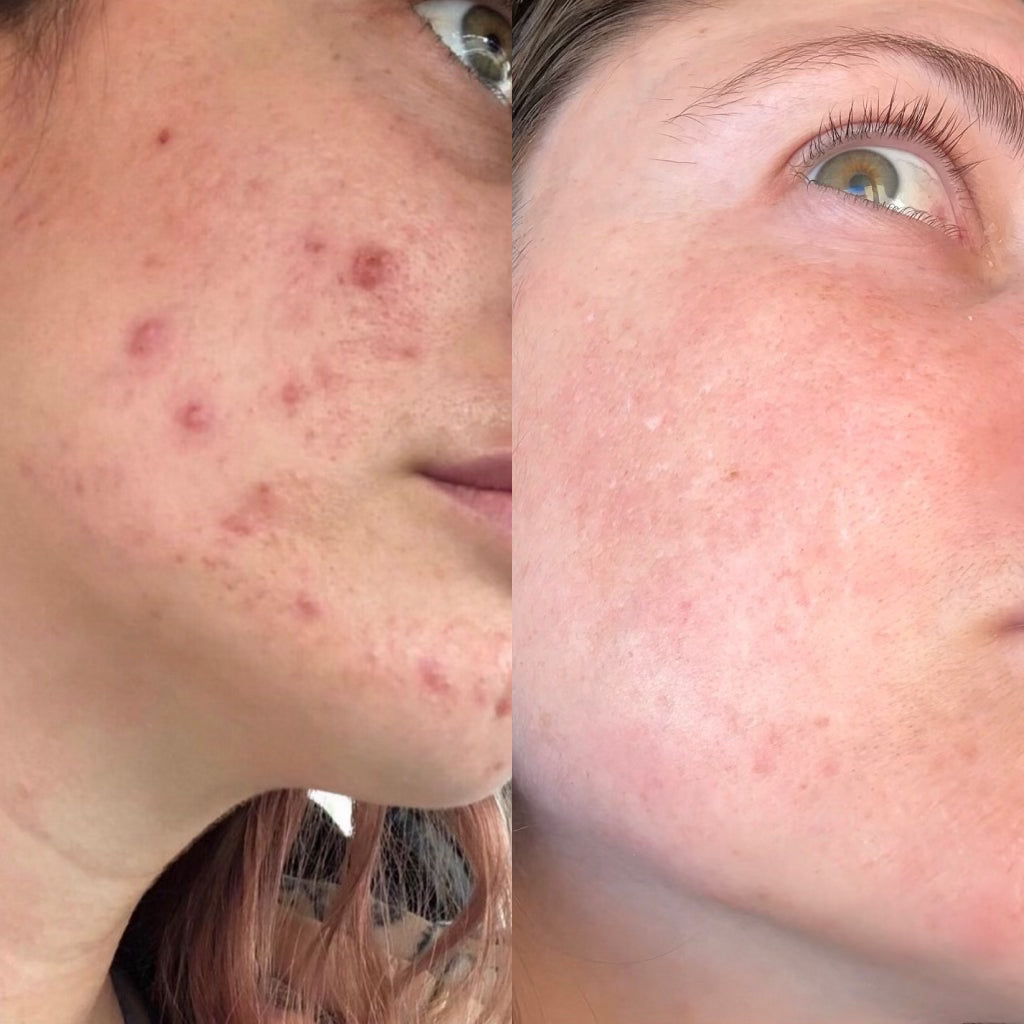 Tallow Skincare Set - Organic Beef Tallow