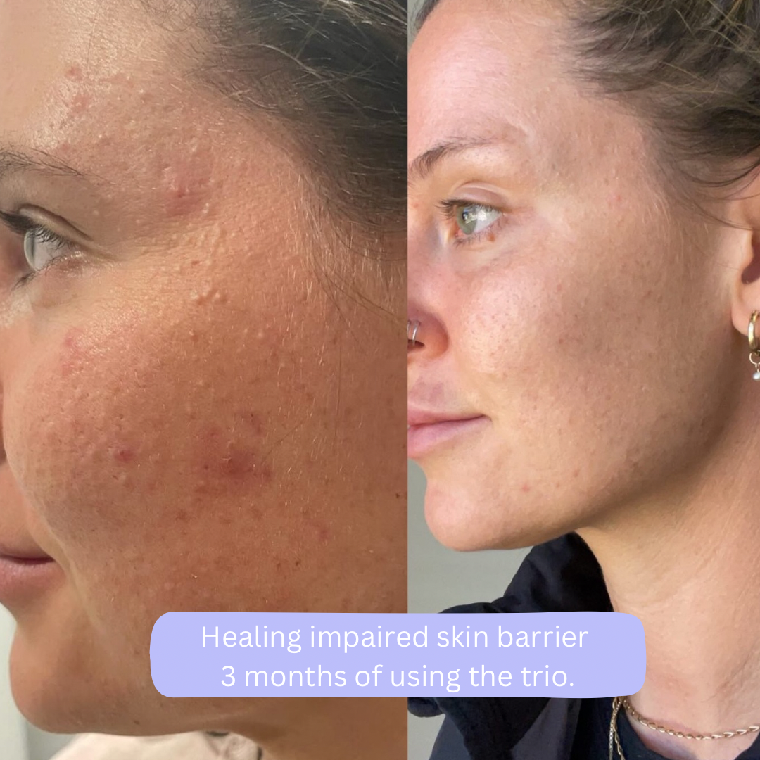 Tallow Skincare Set - Organic Beef Tallow