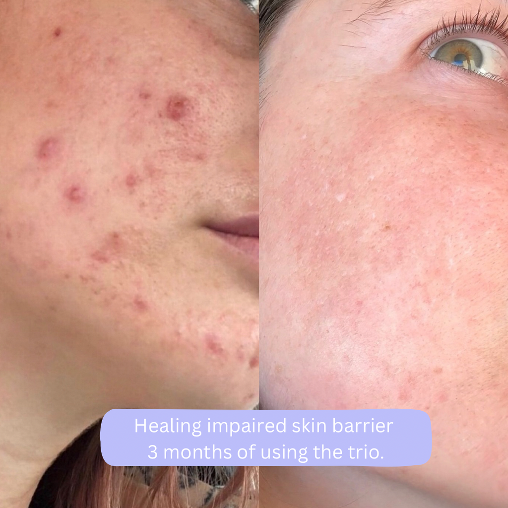 Hydration Bundle - Beef Tallow Moisturiser + Hyaluronic Acid