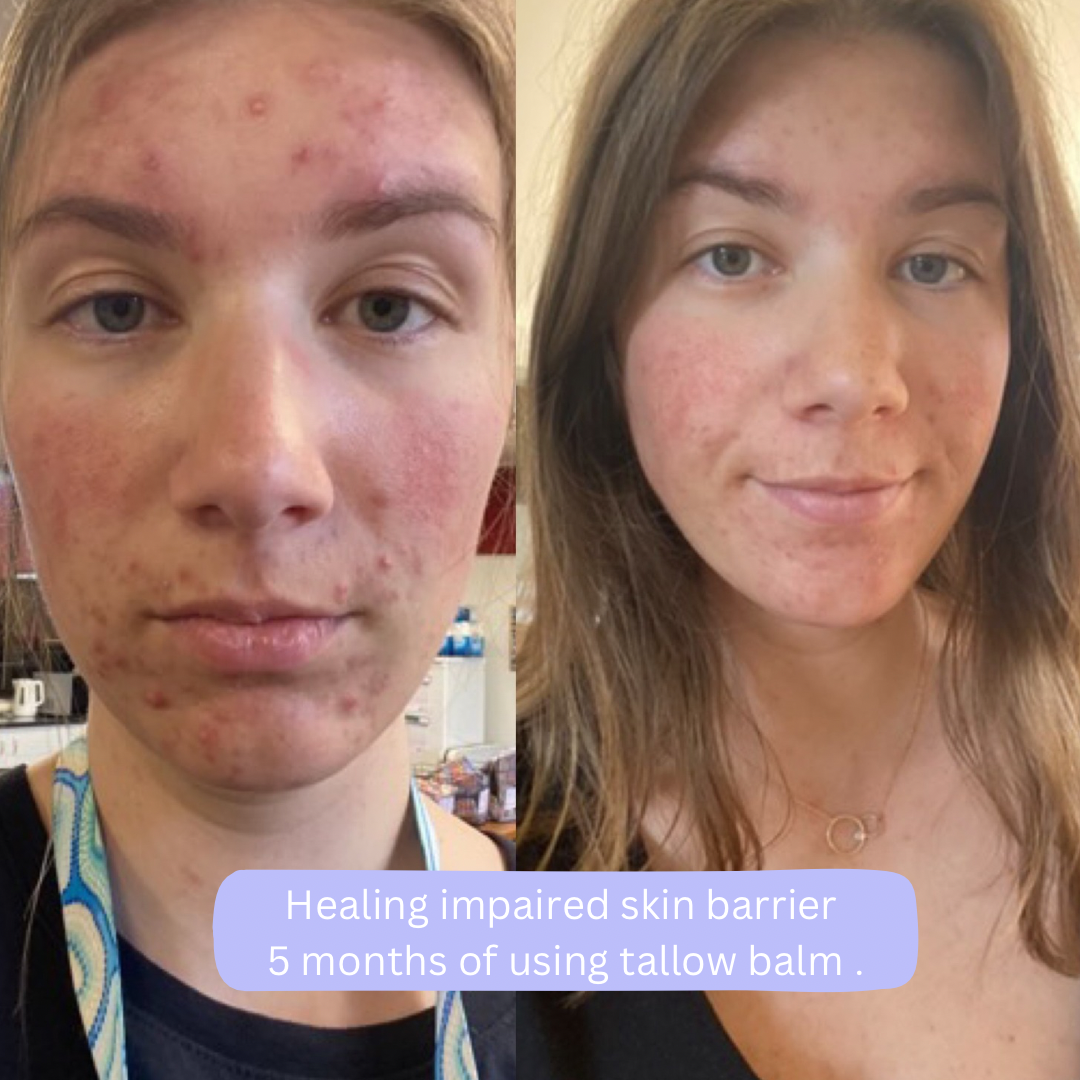 Beef Tallow Balm Results